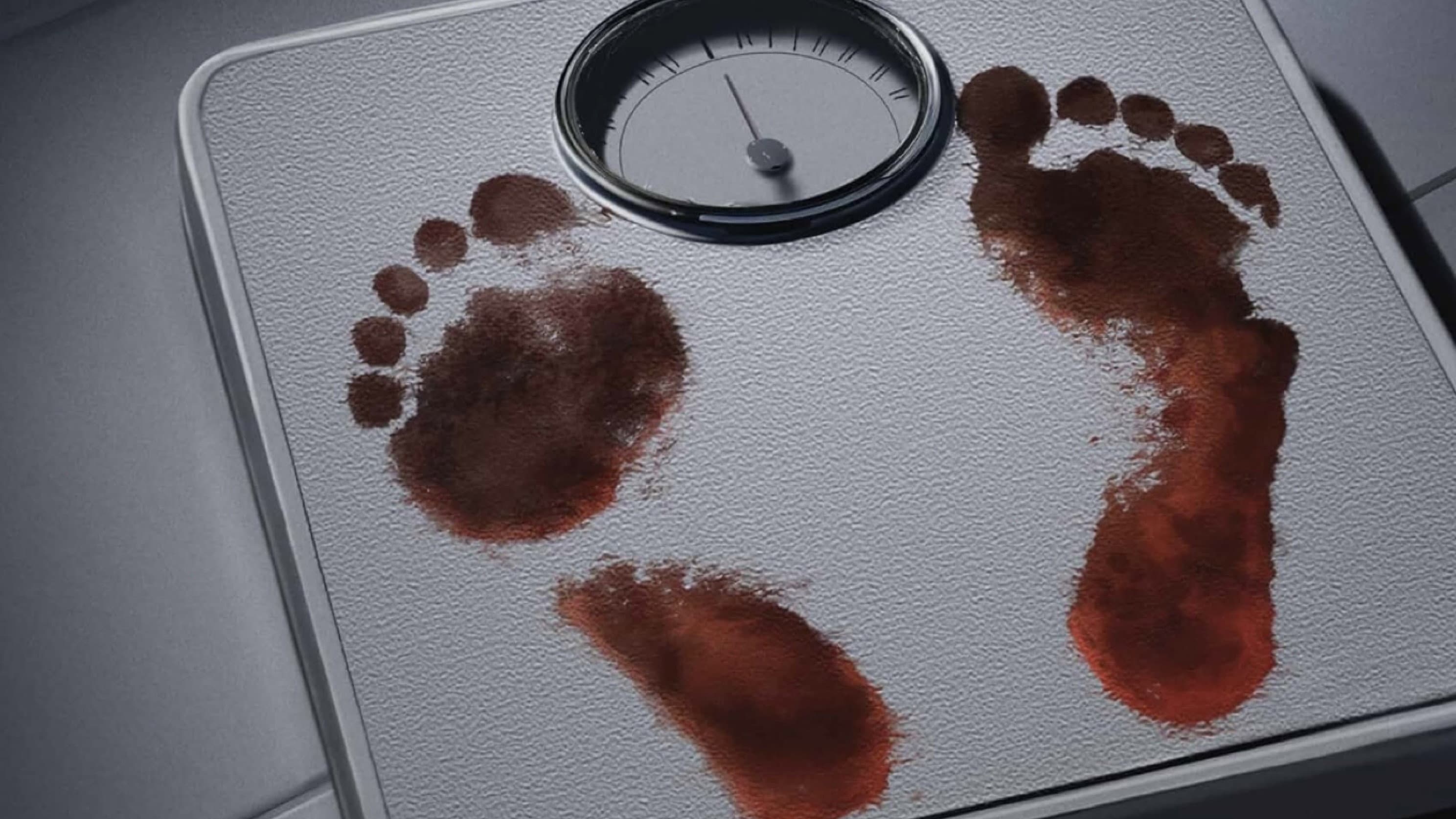 Thick Skin - immagine