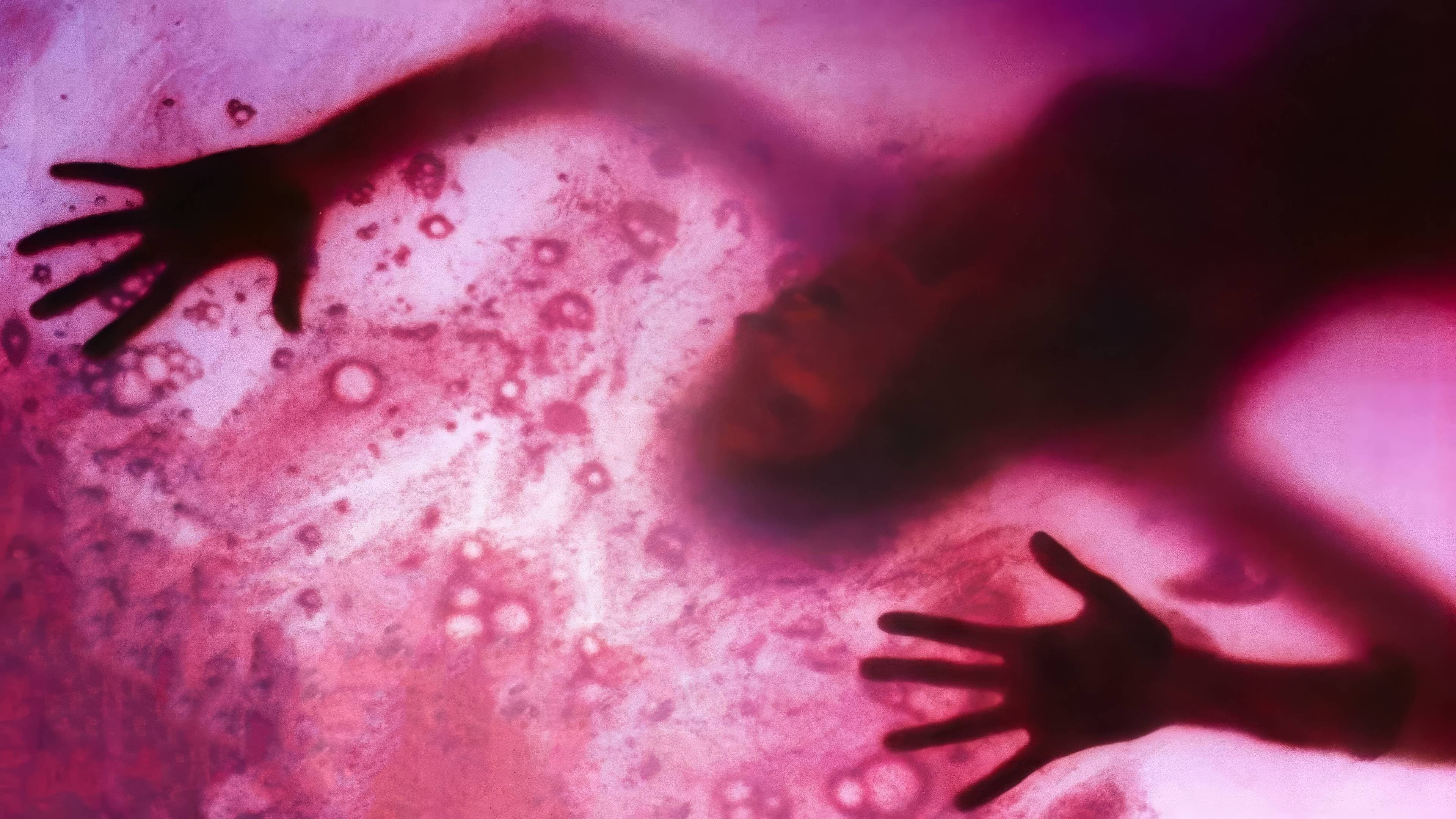 Blob - Il fluido che uccide - immagine