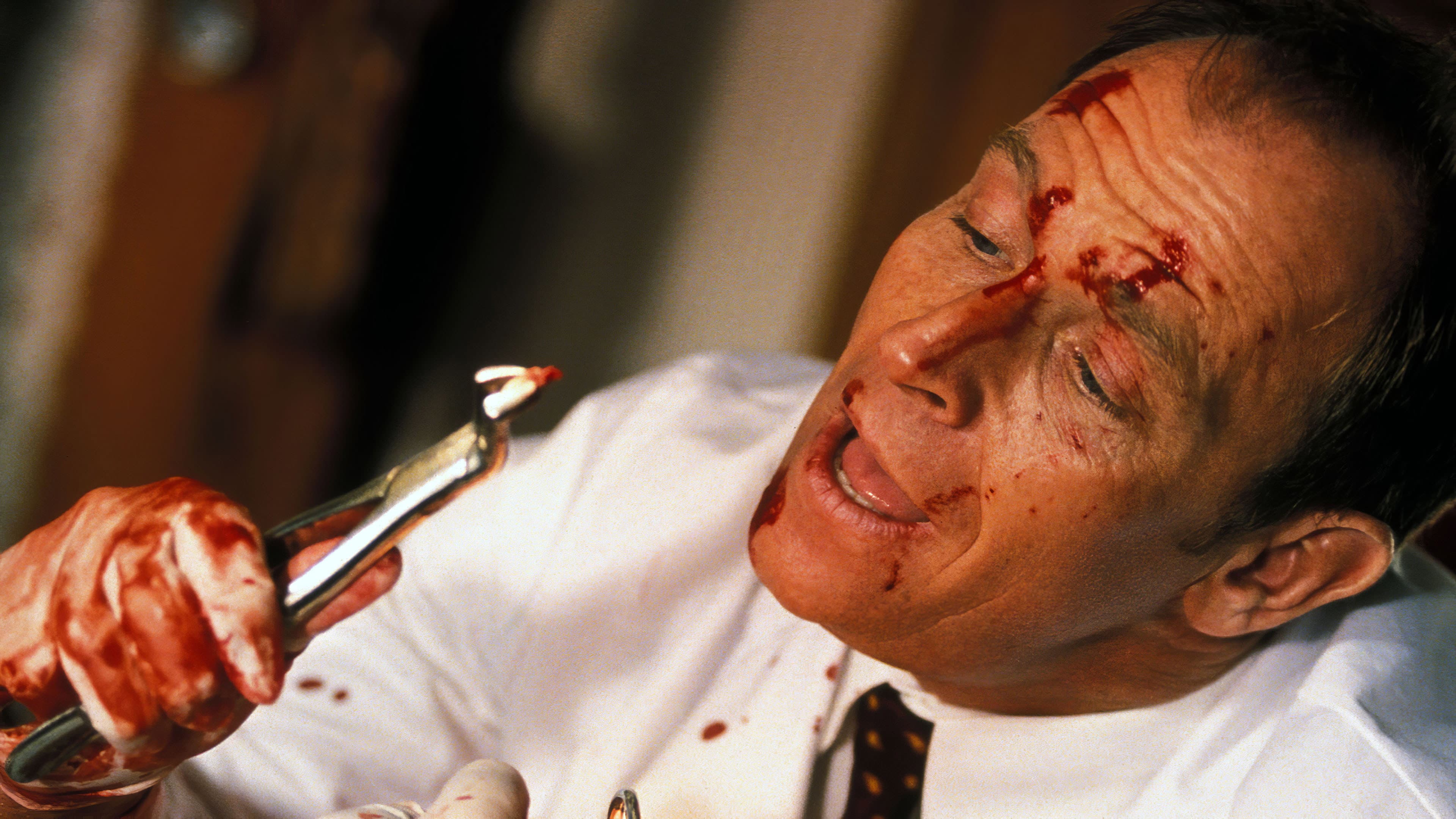 The Dentist 2 - immagine