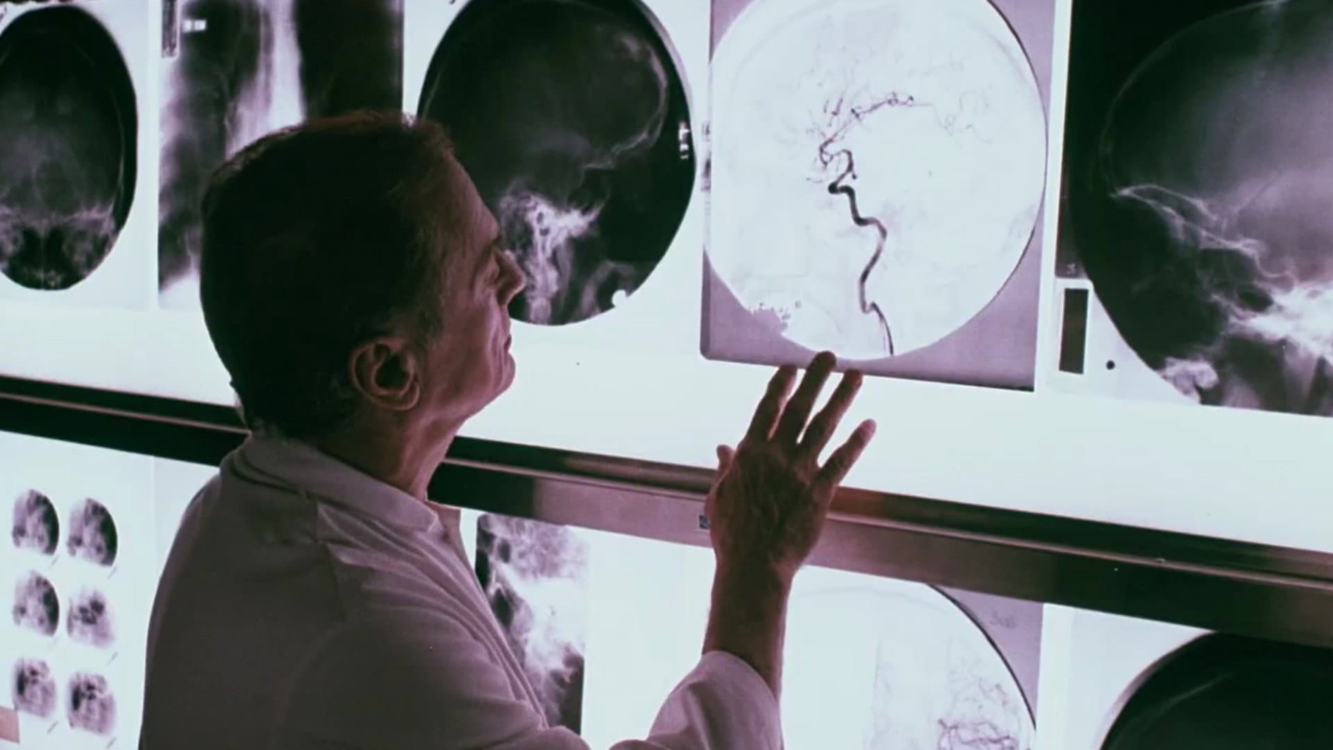 Brainwaves onde cerebrali - immagine